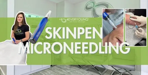  SkinPen Microneedling for Smoother, Brighter and Younger-Looking Skin at 4Ever Young Marietta 