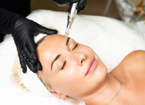Dermatologist performing microneedling treatment on a woman’s face