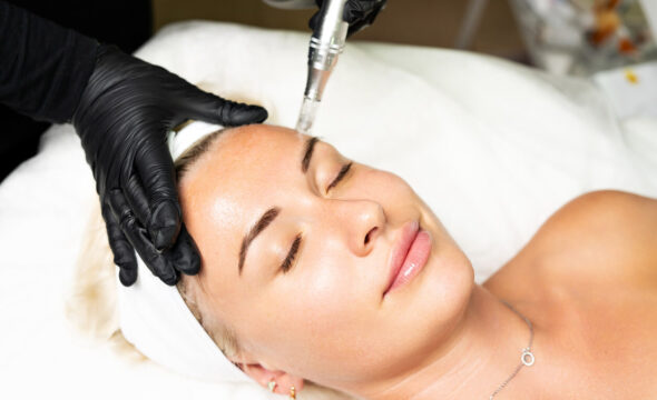  How Often Should You Do Microneedling 