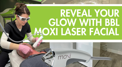 Moxi laser Merritt Island, BBL facial Merritt Island, laser skin rejuvenation Florida, gentle laser facial, sun damage treatment laser