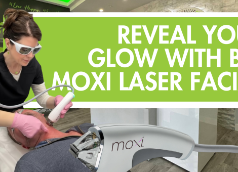 Moxi laser Merritt Island, BBL facial Merritt Island, laser skin rejuvenation Florida, gentle laser facial, sun damage treatment laser