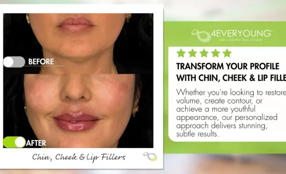  Complete Facial Balancing: How Chin, Cheek, and Lip Fillers Work Together for a Harmonious Look 