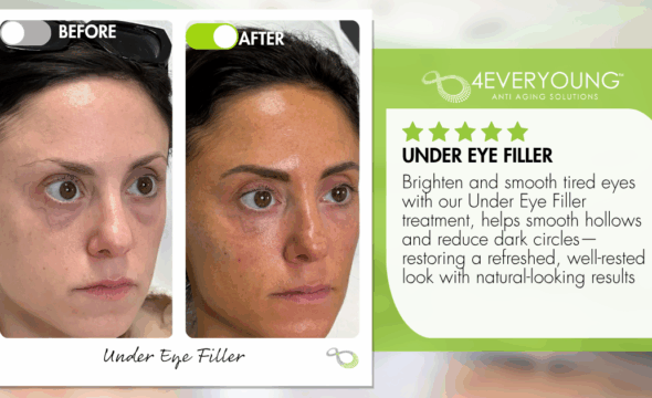  Brighter Eyes, Bolder Confidence: How Under-Eye Fillers Are Transforming Faces in Montvale 