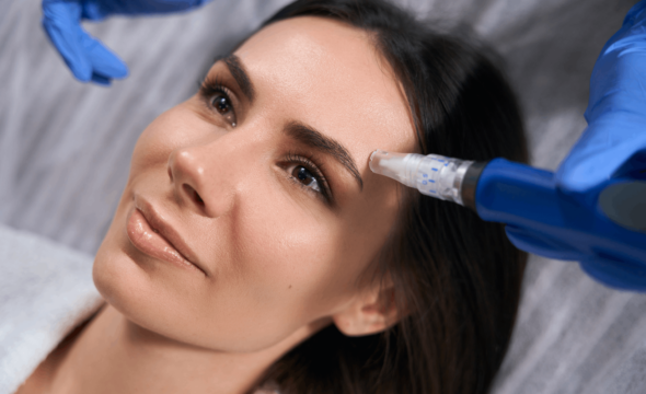  SkinPen® Microneedling Stimulates Your Own Collagen 