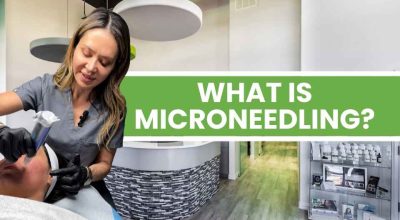 microneedling