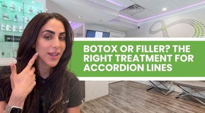 accordion lines Parkland Botox Parkland filler for cheek lines Parkland Sculptra Parkland Juvederm Voluma Parkland Restylane Contour Parkland cheek filler Parkland 4Ever Young Parkland aesthetics