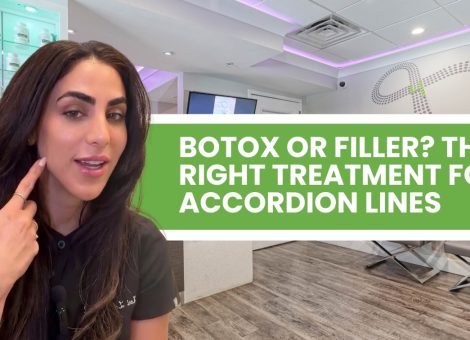 accordion lines Parkland Botox Parkland filler for cheek lines Parkland Sculptra Parkland Juvederm Voluma Parkland Restylane Contour Parkland cheek filler Parkland 4Ever Young Parkland aesthetics