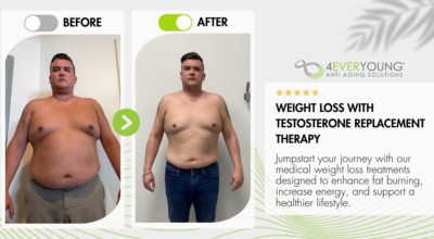 medical weight loss, testosterone therapy