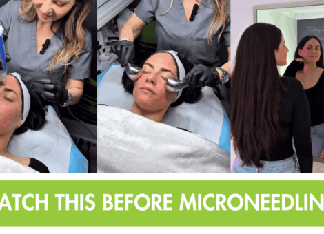 Microneedling in Princeton | Skin Strength & Renewal at 4Ever Young
