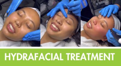 Hydrafacial treatment 4ever young anti aging solutions Ramsey medspa