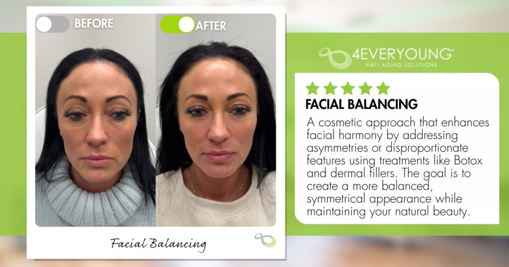 Facial Balancing Ridgewood NJ 4ever young ani-aging solutions