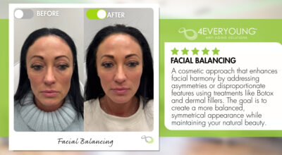 Facial Balancing Ridgewood NJ 4ever young ani-aging solutions