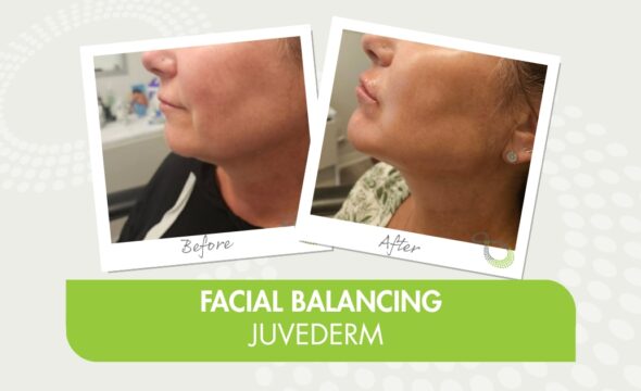  Juvederm Fillers Explained: Which One Is Right for You? 