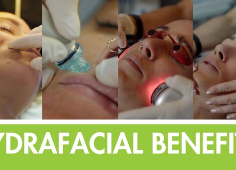 Hydrafacial benefits