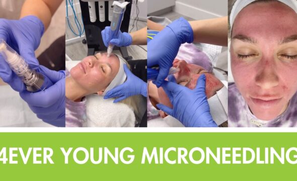  How Microneedling Stimulates Collagen for Youthful Skin 