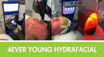 4ever young hydrafacial