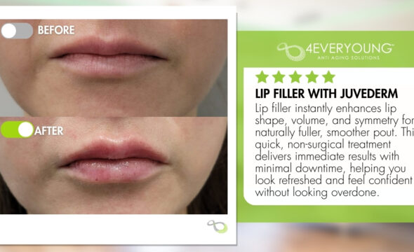  Juvederm for Lips in Loudoun: Finding the Perfect Balance for Your Look 