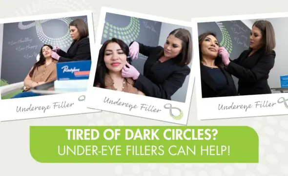  Brighten Tired Eyes: How Under-Eye Fillers Can Transform Dark Circles & Hollows 