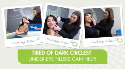 Undereye Filler