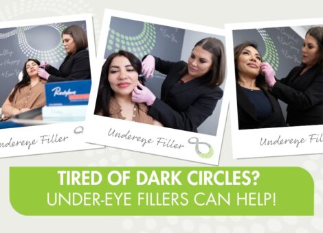 Undereye Filler