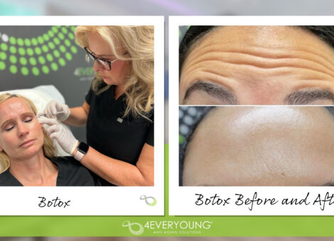 botox near me wilchester
