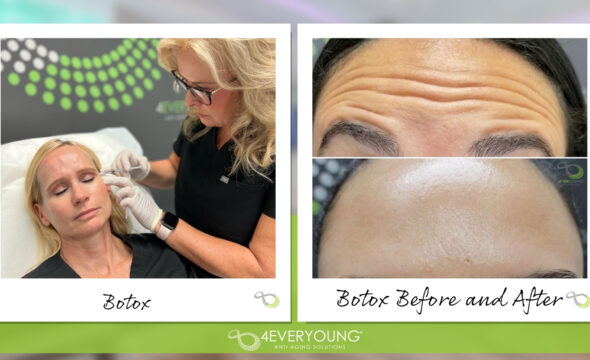  Top 5 Questions to Ask Before Booking Botox Near Me 