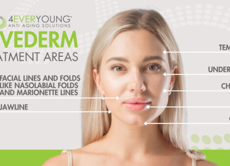 Juvederm