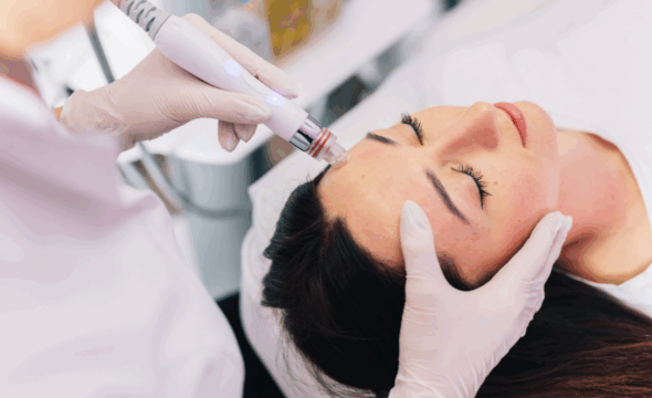 Morpheus8: Deep Skin Rejuvenation with RF Microneedling