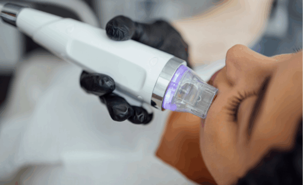  5 Tips for Choosing the Best Med Spa for Microneedling 