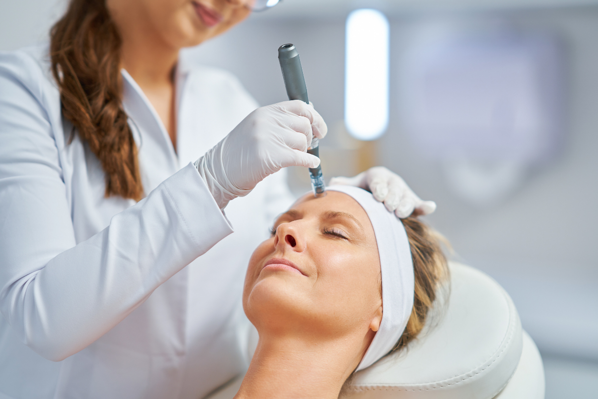 RF microneedling session performed on a woman's face by a professional wearing white gloves.
