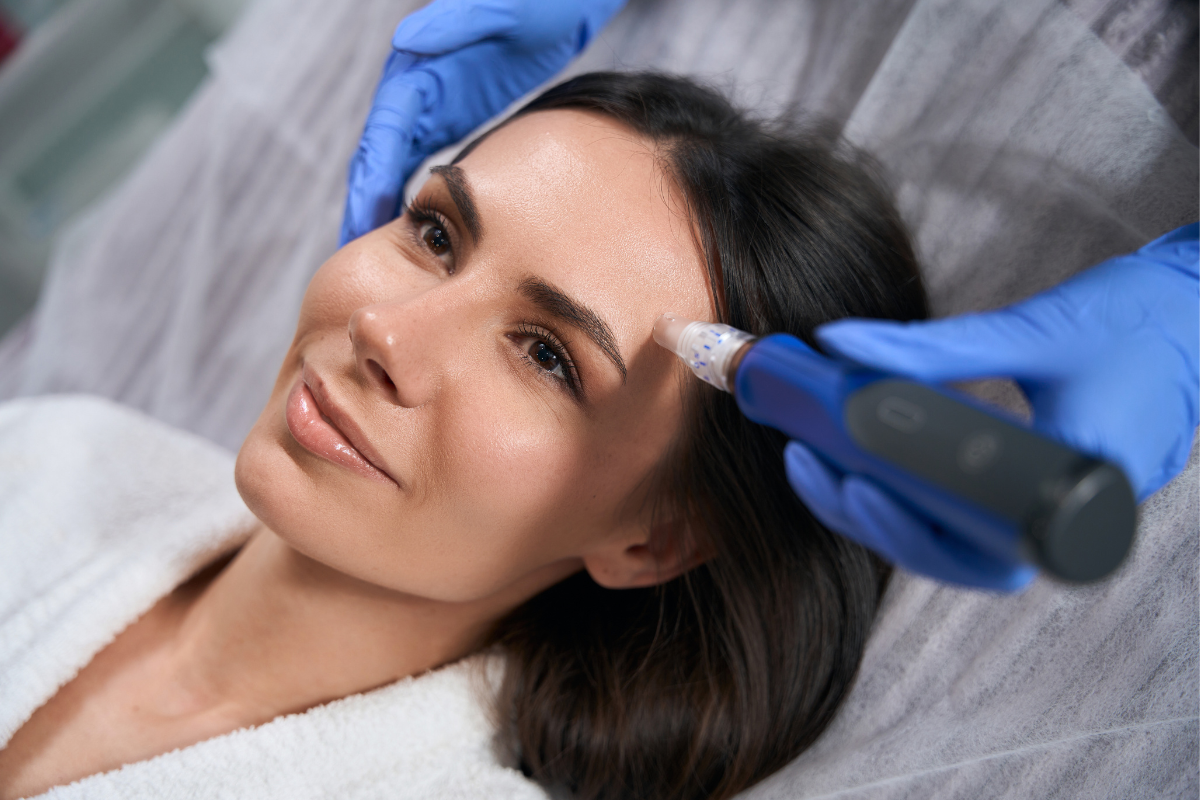 Morpheus8 treatment applied to a woman's forehead using a blue microneedling device by a gloved technician.