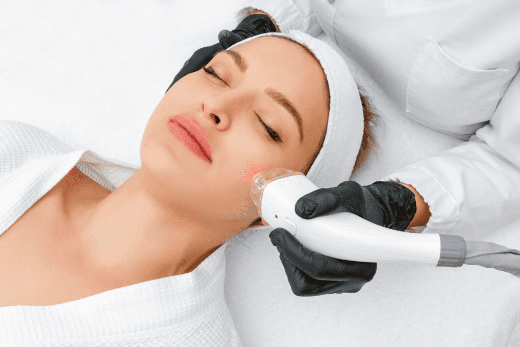 Laser skin resurfacing treatment shown on a woman’s cheek using advanced dermatological equipment.