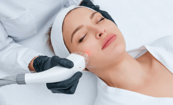  Microneedling Before and After: What Results Can You Expect? 