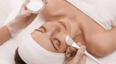 Chemical Peels Explained: What Every First-Time User Should Know