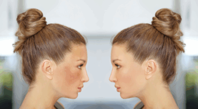 How to Combat Hyperpigmentation with Medical-Grade Skincare
