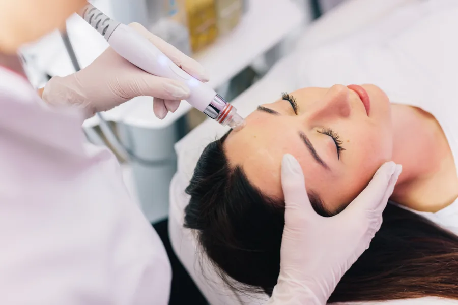 Morpheus8 radiofrequency microneedling treatment at a 4Ever Young center